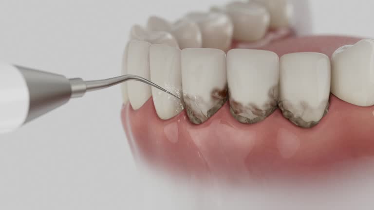 Reliable Emergency Dentist contractor in Foley, AL by Smile Center Dentistry